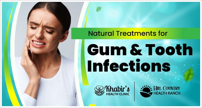 Natural Treatments for Gum & Tooth Infections